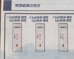 新型コロナウイルス抗体検査は「5,000円くらいで実施できるので一度やってみてください!」